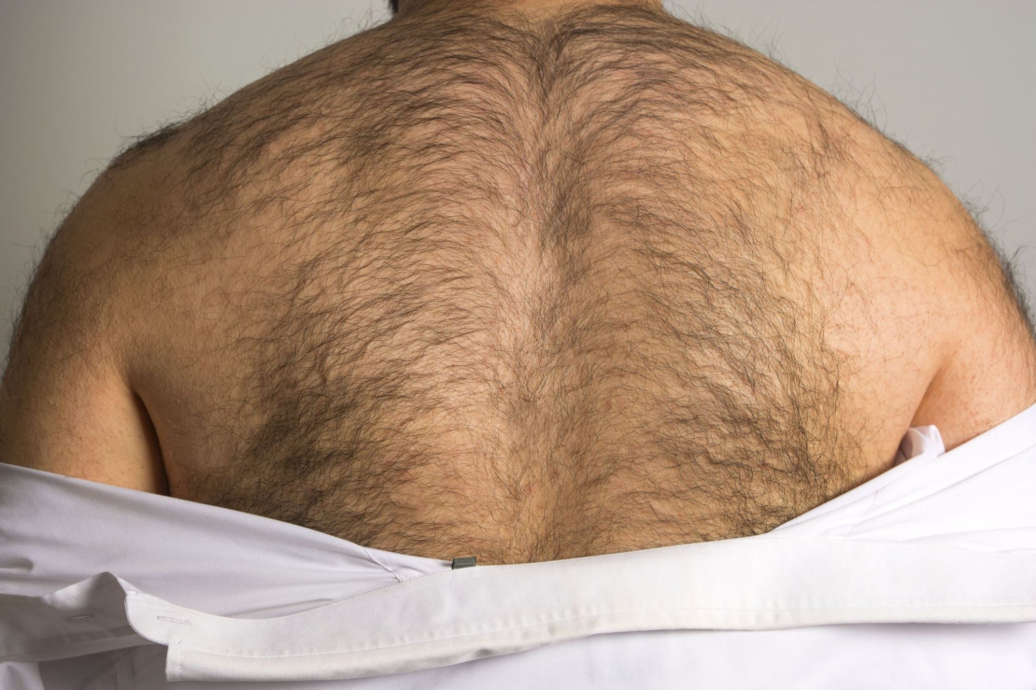 How To Get Rid Of Back Hair Permanently At Home Trimbeast